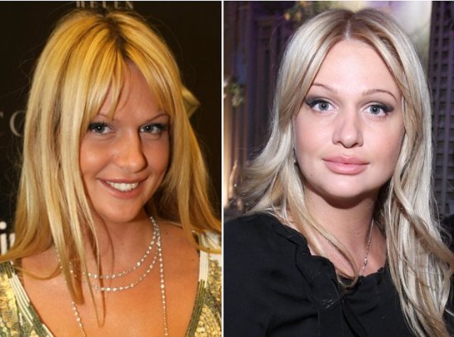 Victoria Lopyreva. Photos before and after plastic surgery, growth, biography, personal life, Basque, Instragram