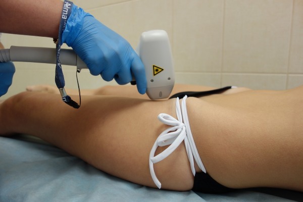 Epilazione della zona bikini a casa: shugaring, cera, laser a zona profonda