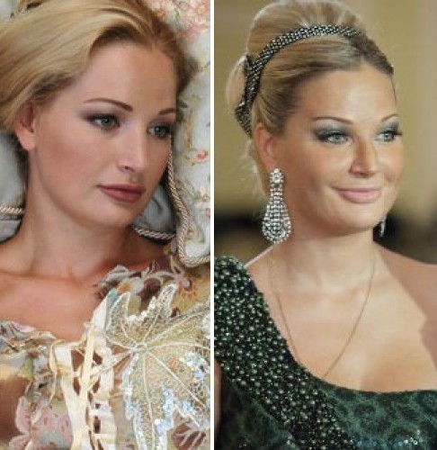 Maria Maksakova before and after plastic surgery photo. Biography and personal life, children of the opera singer. Plastic surgery