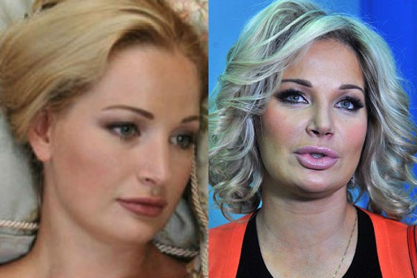 Maria Maksakova before and after plastic surgery photo. Biography and personal life, children of the opera singer. Plastic surgery