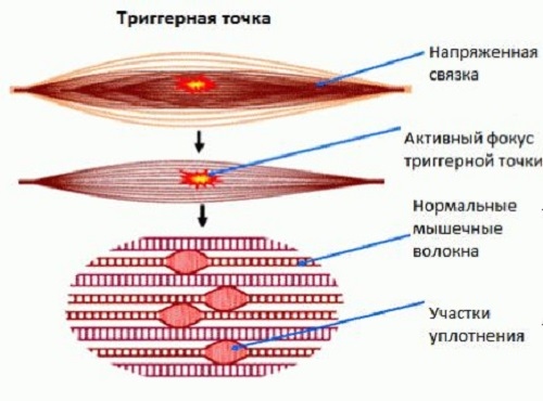 Myofascial massage - what is it, learning how to massage the face, body, back. Photo, video lessons by Shubina