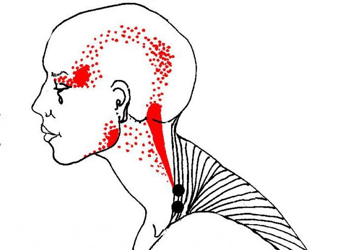 Myofascial massage - what is it, learning how to massage the face, body, back. Photo, video lessons by Shubina