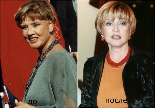 Vera Alentova - photo before and after plastics, what the actress looks like now, biography