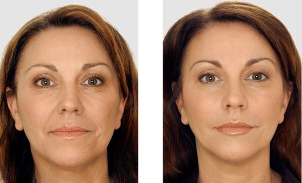 Revitonics - face building, face gymnastics. Exercise, anti-wrinkle fitness, for elasticity of the skin, muscles of the neck and face