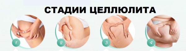 Anti-cellulite massage at home. How to do for slimming the abdomen, legs, buttocks and other parts of the body. Step by step instructions with photo