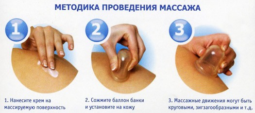 Anti-cellulite massage with vacuum cups at home. How to do it right, technique, contraindications, results and photos