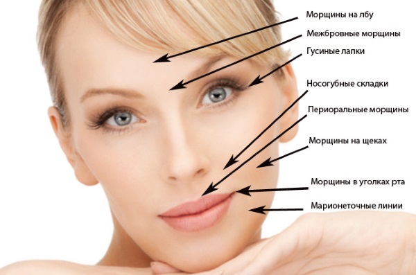 Hyaluronic acid for the face: how the injections are carried out, results, photos before and after injections, reviews