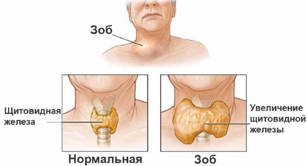 The hormone TSH - what is it, the rate of thyroid hormone in women, treatment of low and high levels