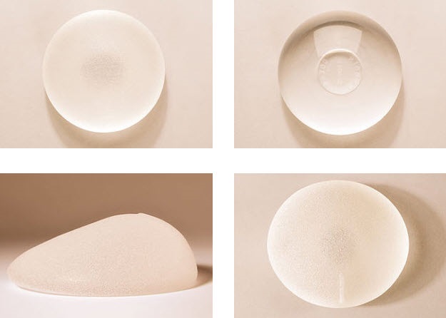 Breast implants - types, installation, cost and photos before and after mammoplasty