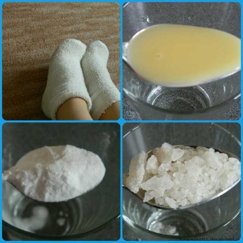 How to remove rough skin from heels quickly and effectively at home