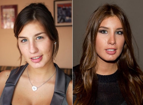 Katie Topuria - photo before and after plastic surgery. What operations did the star do, how much and how her appearance changed