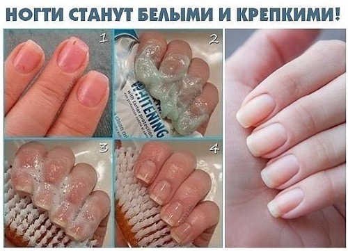 Masks for strengthening nails at home. Folk methods and recipes, vitamins