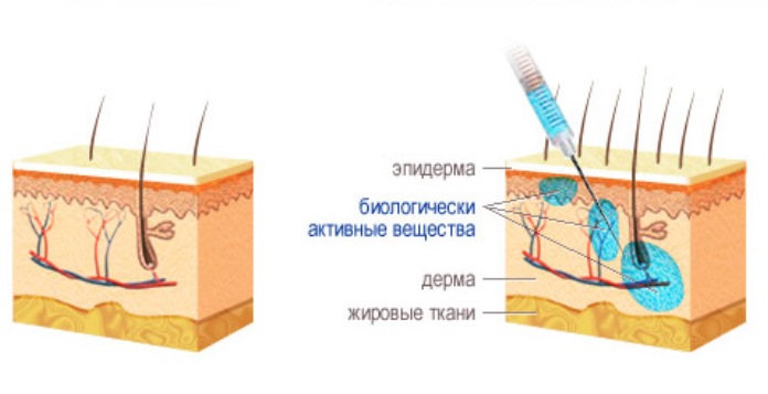 Mesotherapy for hair - what is it in cosmetology, how it is done, what drugs are used. Photos and reviews