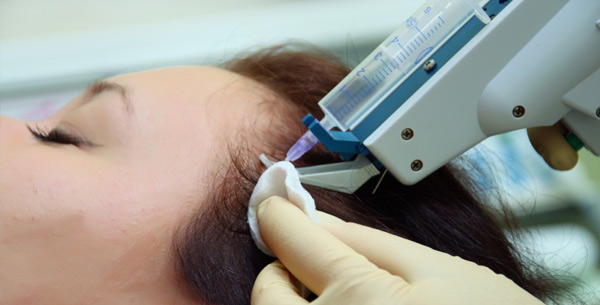 Mesotherapy for hair - what is it in cosmetology, how it is done, what drugs are used. Photos and reviews