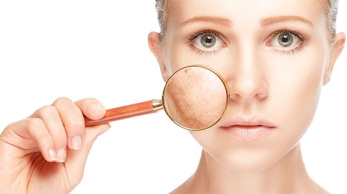 Pigmented spots on the face - how to get rid of at home: folk remedies, ointments from the pharmacy, drugs in cosmetology