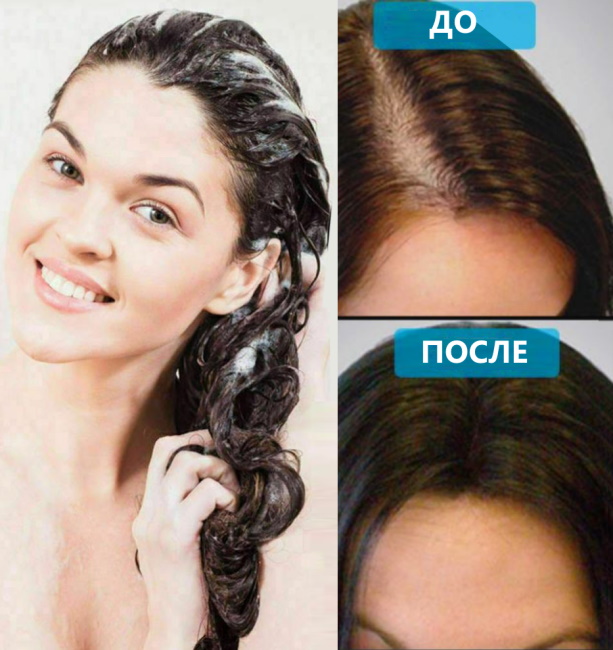 Medical shampoos for hair loss in the pharmacy. Top 10 Rating of the most effective remedies