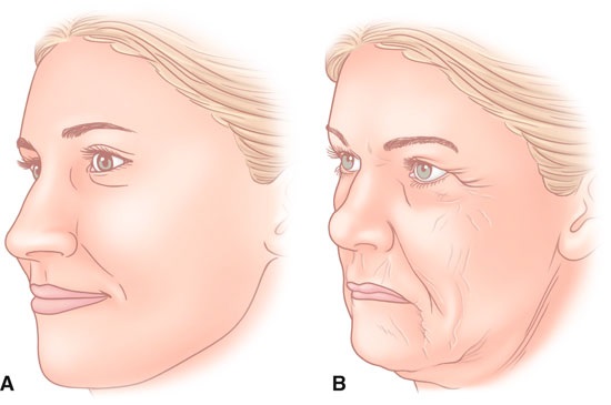 SMAS lifting - ultrasonic face cleaning. Features of the procedure, indications, contraindications, expected effect, photo