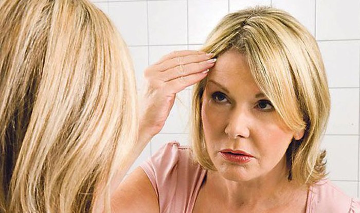 Hair loss in women - how to stop, what to do: shampoos, oils, masks, vitamin complexes