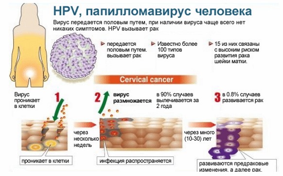 HPV nelle donne: che cos'è, sintomi, tipi, come viene trasmesso, trattamento del papillomavirus umano in ginecologia