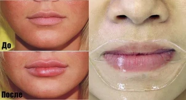 How to plump lips with a glass, bottle, makeup, lip augmentation exercises at home