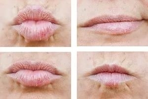 How to plump lips with a glass, bottle, makeup, lip augmentation exercises at home