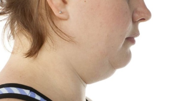 How to remove a double chin at home. Exercises for men, women, thin girls in a short time