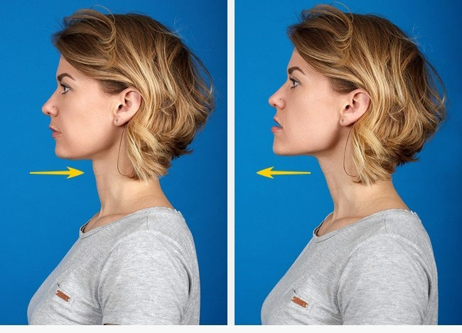 How to remove a double chin at home. Exercises for men, women, thin girls in a short time