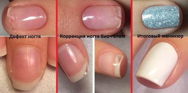 How to strengthen nails with gel under gel polish. Which gels are better to use, how the procedure goes step by step. Instruction with photo