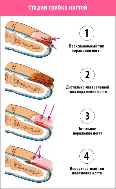 How to strengthen nails with gel under gel polish. Which gels are better to use, how the procedure goes step by step. Instruction with photo