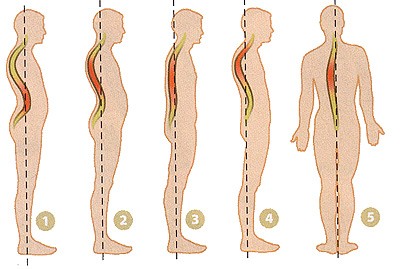 Massaggiatori per schiena e collo, corpo, con osteocondrosi. Come scegliere per uso domestico