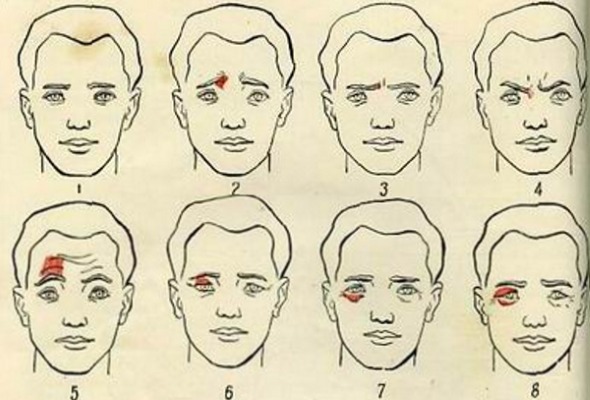 Anatomy of human facial muscles in cosmetology for botox injections. Schemes with descriptions and photos in Latin and Russian