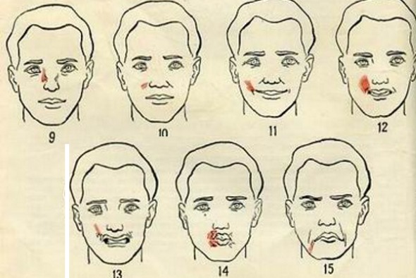 Anatomy of human facial muscles in cosmetology for botox injections. Schemes with descriptions and photos in Latin and Russian