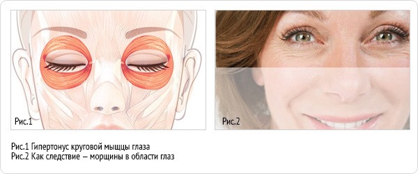 Anatomy of human facial muscles in cosmetology for botox injections. Schemes with descriptions and photos in Latin and Russian