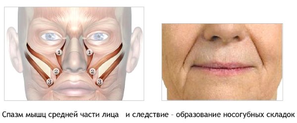 Anatomy of human facial muscles in cosmetology for botox injections. Schemes with descriptions and photos in Latin and Russian