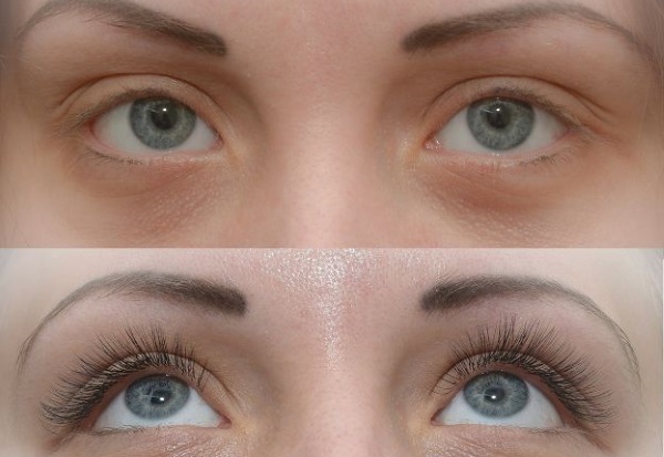 Eyelash extension: types, techniques, effects, photos, pros and cons, how it is done, consequences and harm