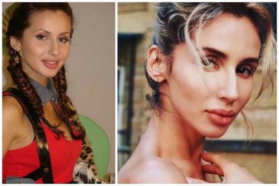 Svetlana Loboda before and after plastic surgery. Photo of face, nose, lips, chest. Singer biography, age, shape parameters, height and weight