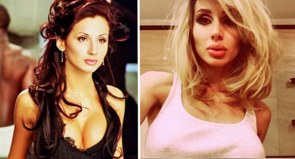 Svetlana Loboda before and after plastic surgery. Photo of face, nose, lips, chest. Singer biography, age, shape parameters, height and weight