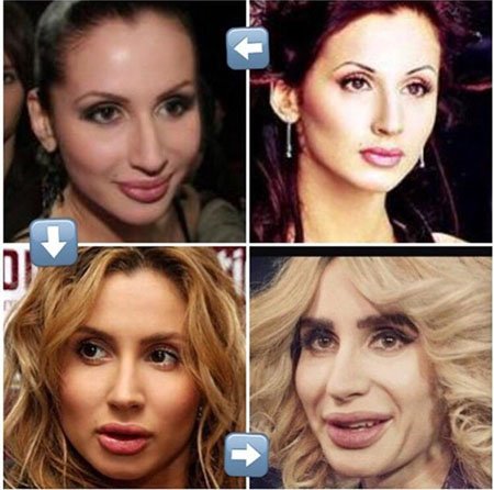 Svetlana Loboda before and after plastic surgery. Photo of face, nose, lips, chest. Singer biography, age, shape parameters, height and weight