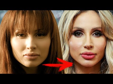 Svetlana Loboda before and after plastic surgery. Photo of face, nose, lips, chest. Singer biography, age, shape parameters, height and weight