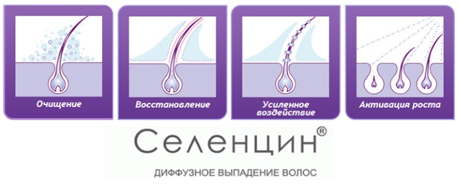 Compresse per la crescita dei capelli sulla testa nelle donne e negli uomini. Le migliori vitamine e farmaci nelle farmacie. Recensioni e prezzi