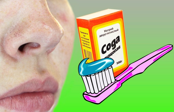 How to apply toothpaste for acne on the face. Recipe for preparation and use, photo