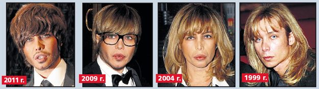 Unsuccessful plastic surgery. Photos of scary Russian and Hollywood stars, men and women