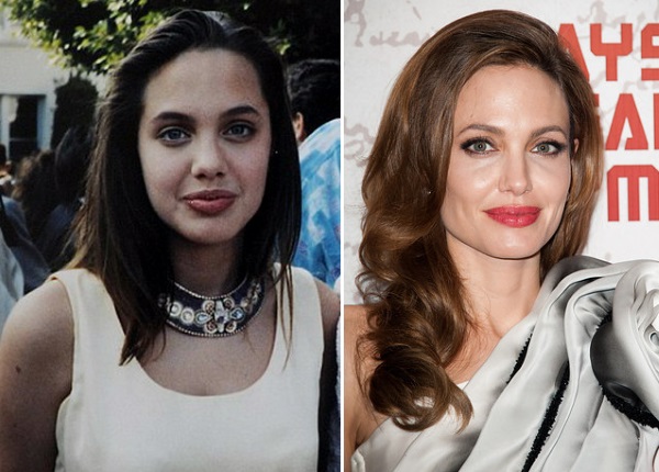 Angelina Jolie prima e dopo la chirurgia plastica. Una selezione di foto dell'attrice prima e dopo la rinoplastica, operazioni di sollevamento del plasma