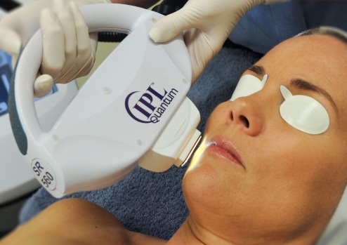 Apparatus for removing age spots, scars, tattoos on the face and body skin. Laser, Fraxel, Elos, M22. Rating and reviews