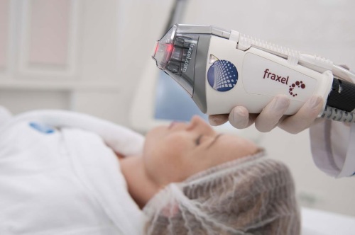 Apparatus for removing age spots, scars, tattoos on the face and body skin. Laser, Fraxel, Elos, M22. Rating and reviews