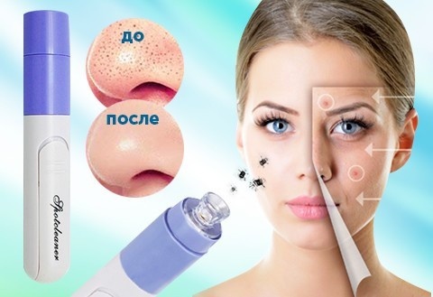 Facial cleansing devices. Species, Top 5 Best for Home Use. How to choose how to use