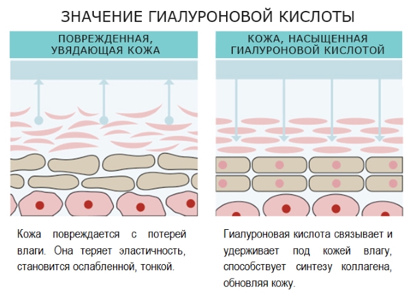 What is biorevitalization of the face, how it differs from mesotherapy, fillers. Indications, contraindications, consequences. A photo