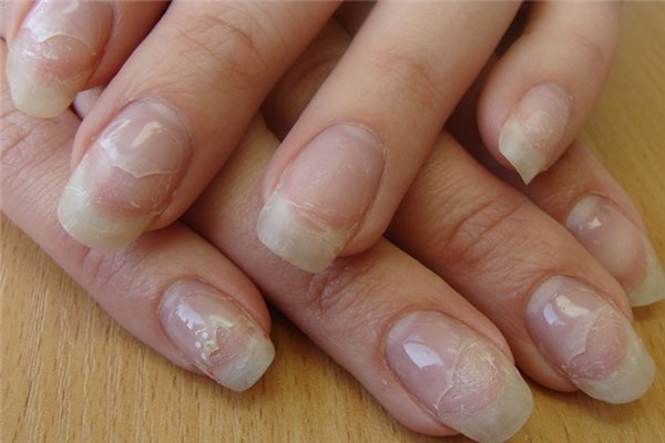 Treatment of nails on hands and feet after gel polish, extension. Folk recipes, pharmacy products, IBX system