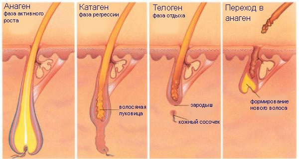 Laser hair removal. Which is better: diode or alexandrite laser for face, body, bikini area. Contraindications and consequences, results, photos