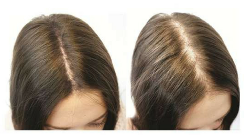 Hair lightening cinnamon mask. Recipes and rules for using at home, on dark and light brown hair, photo